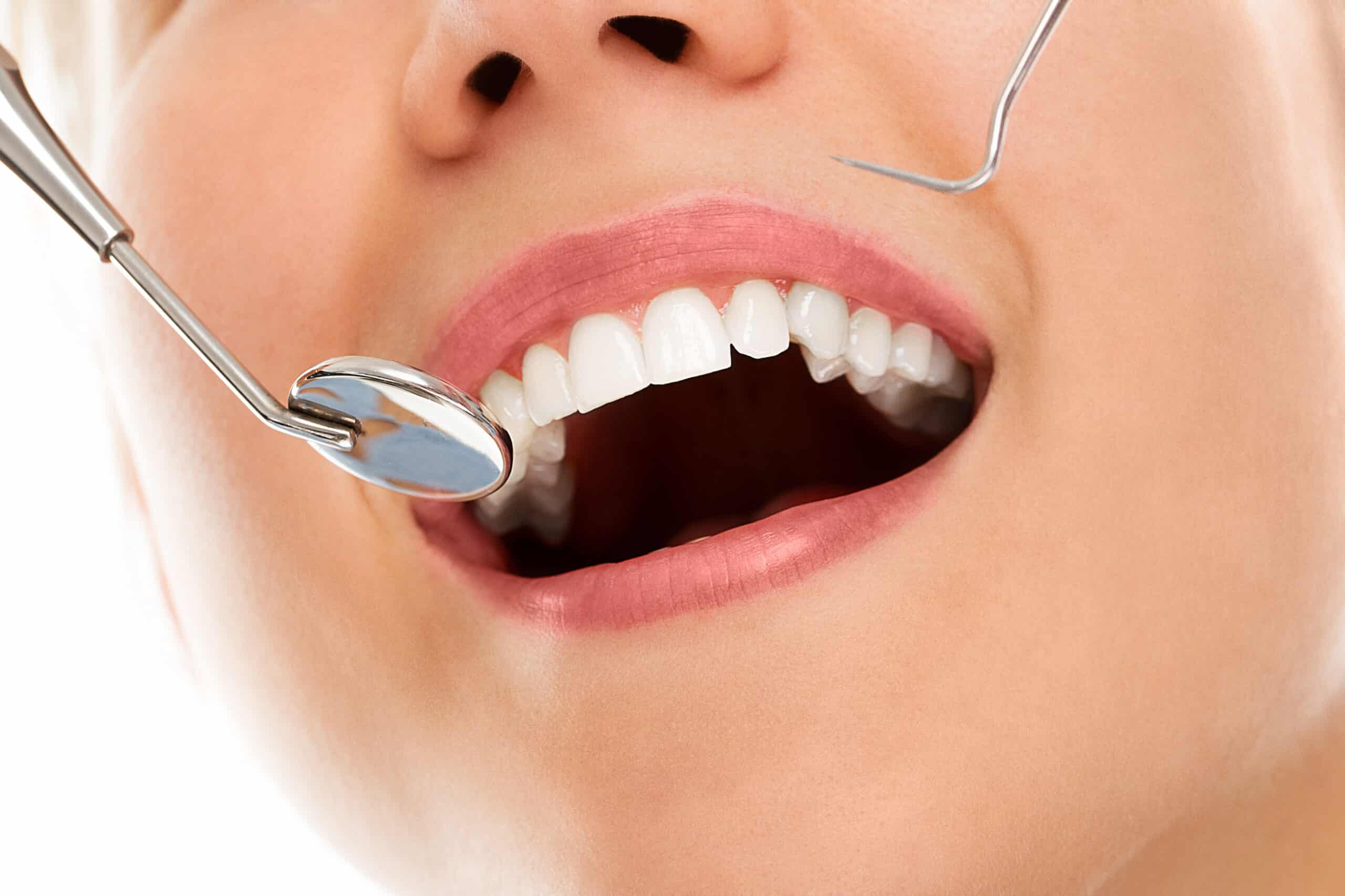 Featured image for “Dental Accessories: Help Kids Show American Spirit with Braces”